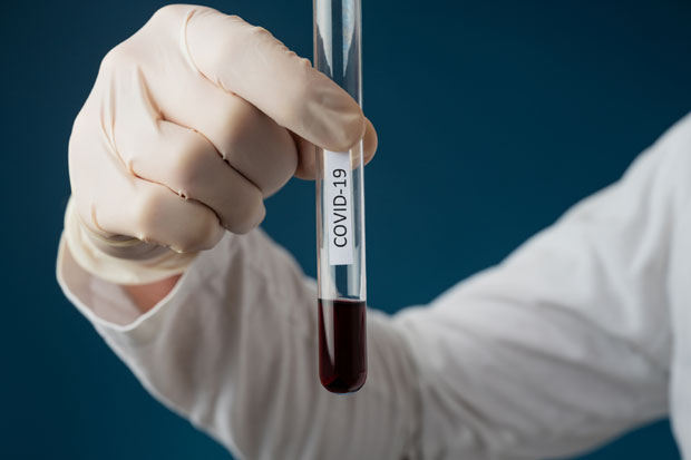 Нових ШЕСТ СЛУЧАЈЕВА вируса корона у Црној Гори